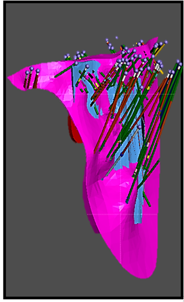 Figure 2: 3-D Model of Dyke 1 with previous and historic drillholes