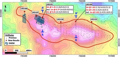 Figure 1 – La Romana gravity anomaly map showing locations of new drillholes LRD187 to LRD192, and cross-section locations A-A’ (Figure 2) and B-B’ (Figure 3) (CNW Group/Pan Global Resources Inc.)